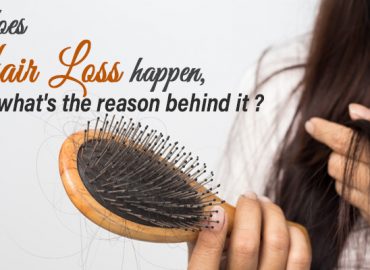 Why does Hair loss happen what’s the reason behind it
