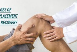 Four stages of knee replacement surgery recovery