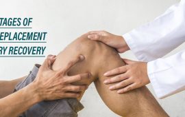 Four stages of knee replacement surgery recovery