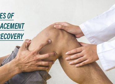 Four stages of knee replacement surgery recovery