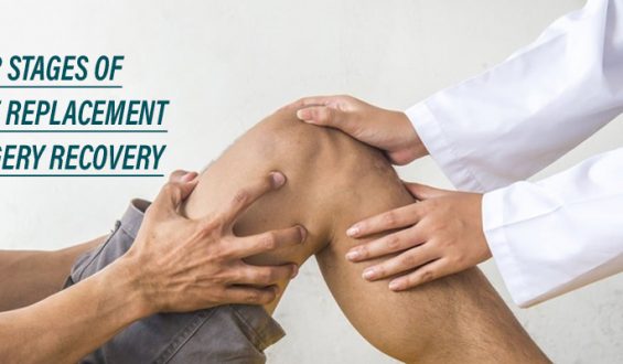 Four stages of knee replacement surgery recovery