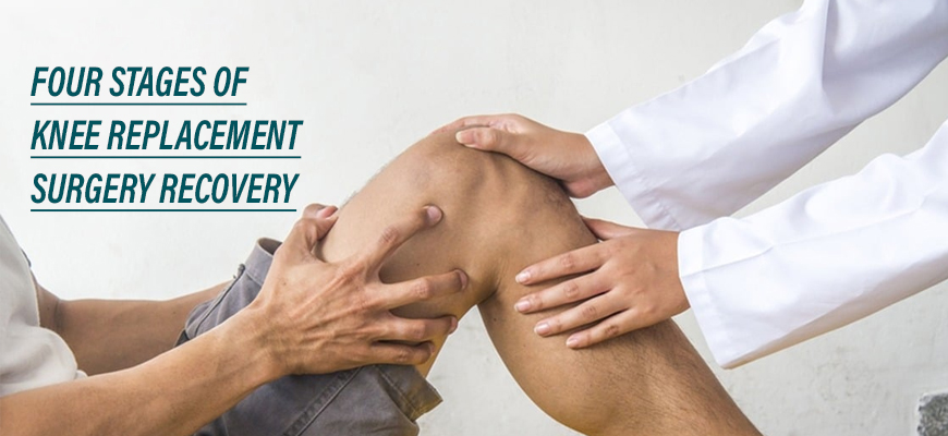 Four stages of knee replacement surgery recovery