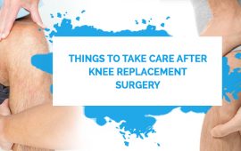 Things To Take Care After Knee Replacement Surgery