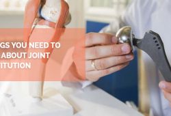 5 Things You Need To Know About Joint Substitution