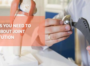 5 Things You Need To Know About Joint Substitution