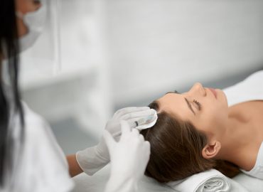 PRP Treatment For Hair Loss