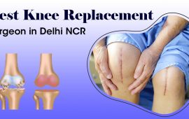 Best Knee Replacement Surgeon In Delhi NCR