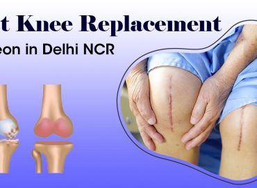 Best Knee Replacement Surgeon In Delhi NCR