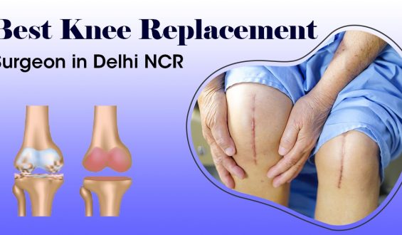 Best Knee Replacement Surgeon In Delhi NCR