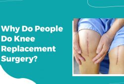 Why Do People Do Knee Replacement Surgery