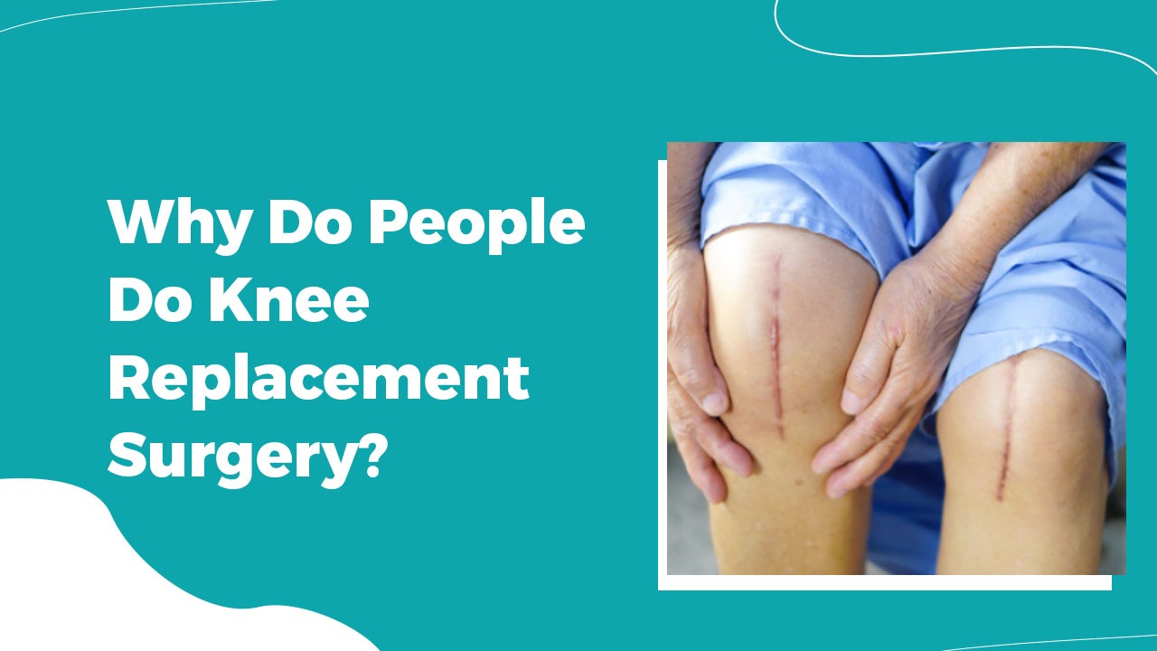 Why Do People Do Knee Replacement Surgery
